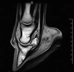 Magnetic Resonance Imaging (MRI)